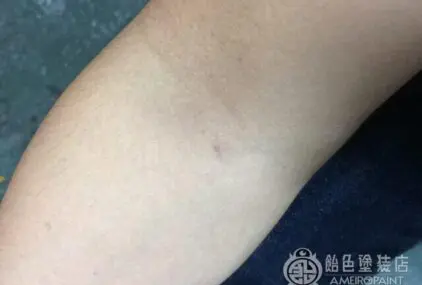 健康診断 チクッのサムネイル画像